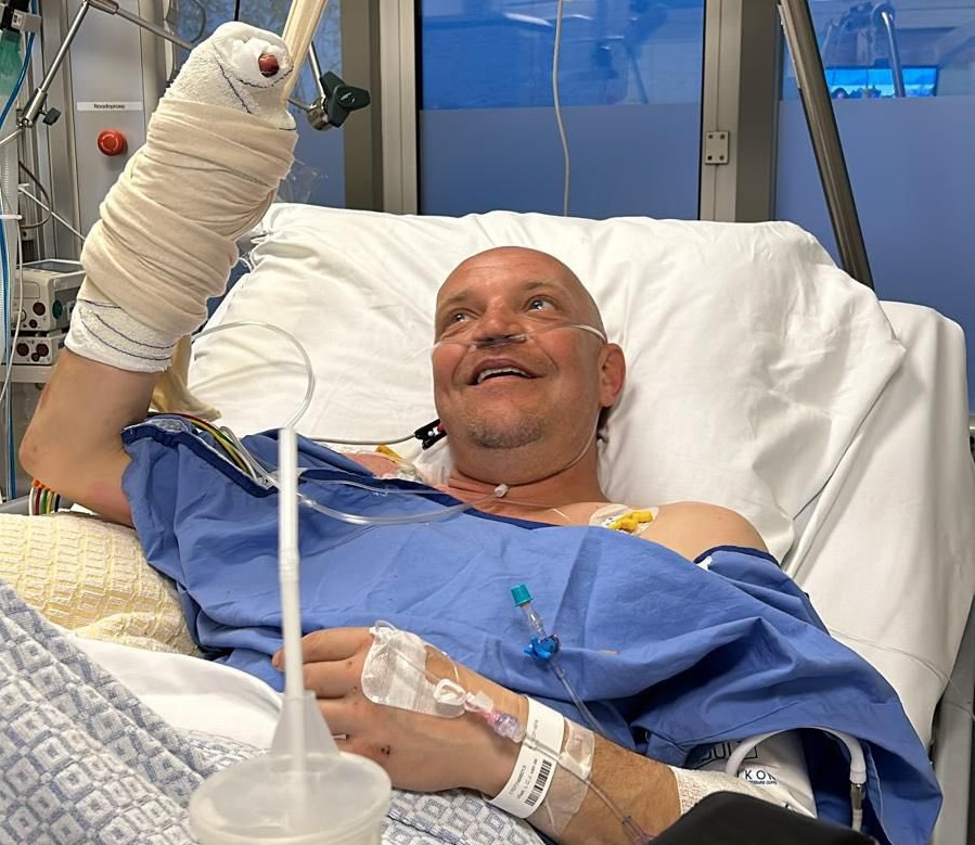 PSV supporter raapte zelf cobra van de straat: wijsvinger, middelvinger en halve duim kwijt